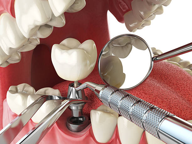 Best Emergency Dental Care for Broken or Chipped Teeth in Muskego, WI