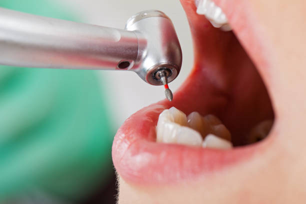 Best Emergency Treatment for Dental Infections or Abscesses in Muskego, WI